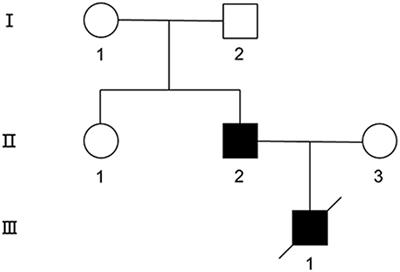 Immunohistochemical Evaluation of Histological Change in a Chinese Milroy Disease Family With Venous and Skin Abnormities